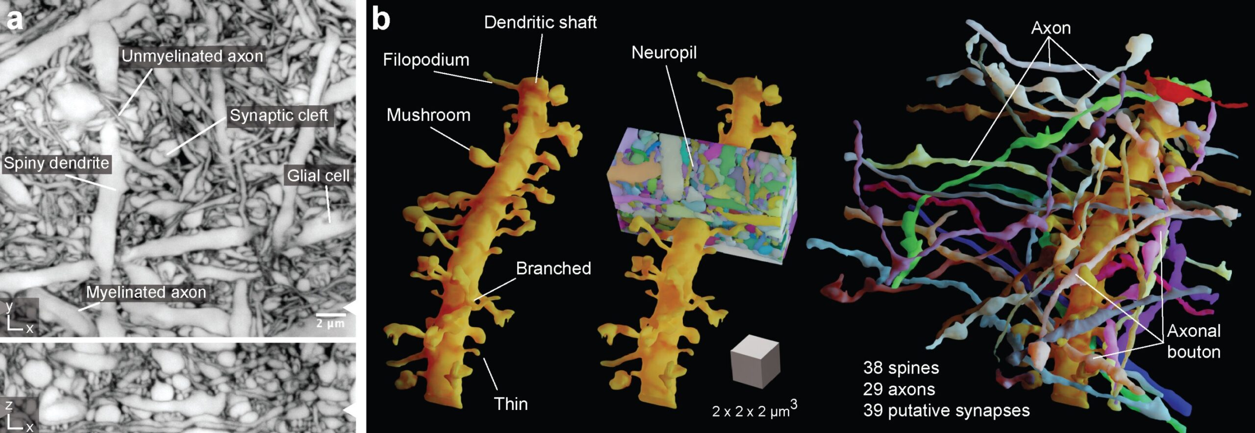 From Neurons to Consciousness: Exploring the Brain’s Complexity